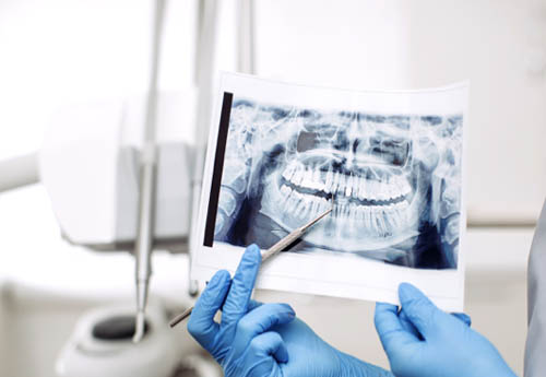 conservative-dentistry