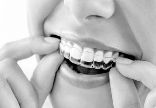 orthodontics