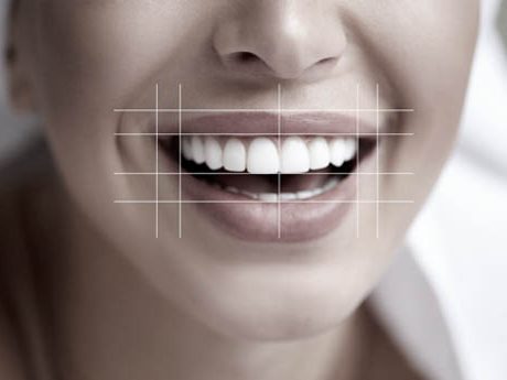 smile-design