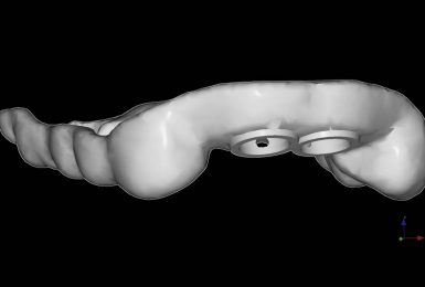 advanced-implantology-and-cosmetic-dentistry