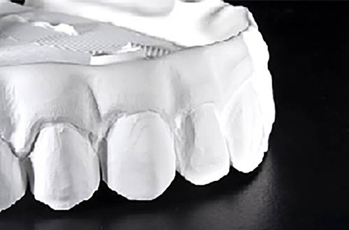 advanced-zirconia-crowns