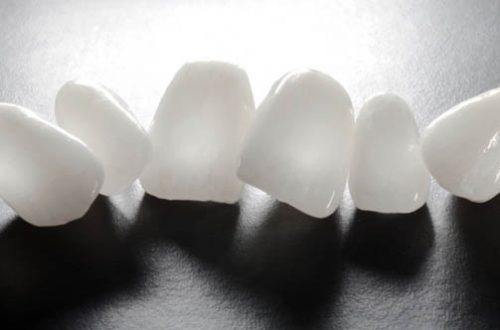 aesthetic-dental-and-implant-surgery