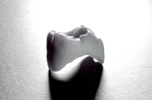 aesthetic-dental-jelusic