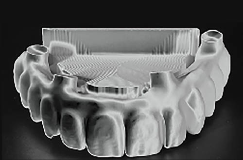 best-aesthetic-dental-medicine-london