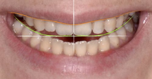 best-dental-specialist-harley-street