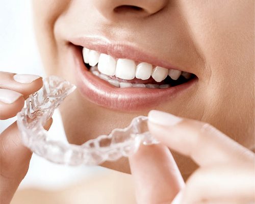 celebrity-dental-orthodontics-london