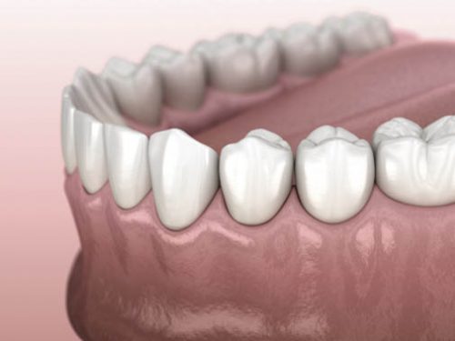 clean-polished-teeth