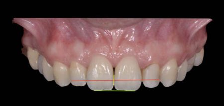 conservative-dentistry