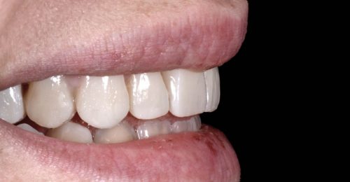 dental-care-london