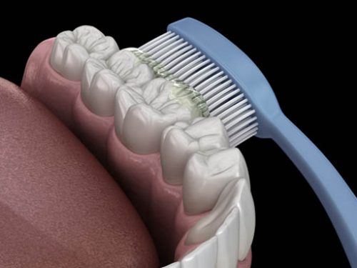 dental-home-care