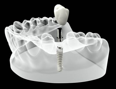 dental-diagnostics-london