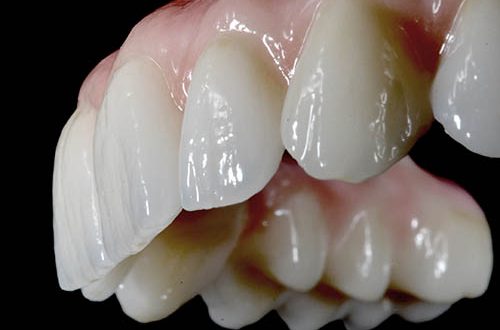 dental-mobile-prosthetics