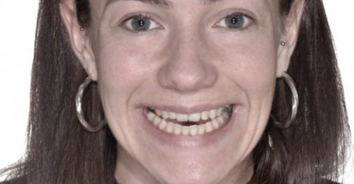 best-dental-specialist-harley-street