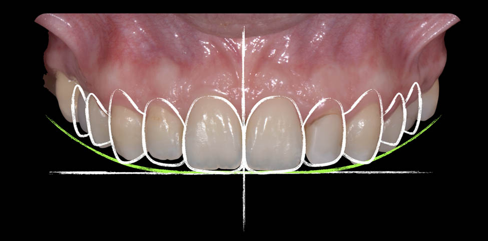 dental-revolution