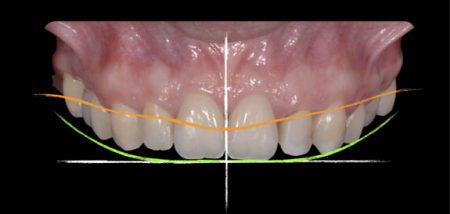 lifestyle-dental-treatment