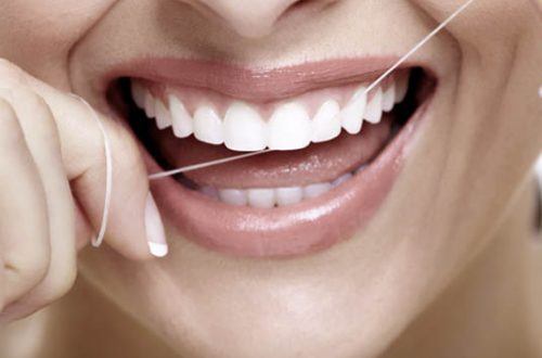 best-teeth-whitening