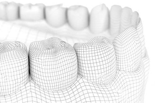 all-on-6-dental-services