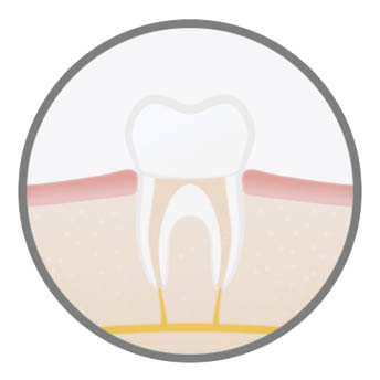 advanced-endodontic-procedure-harley-street