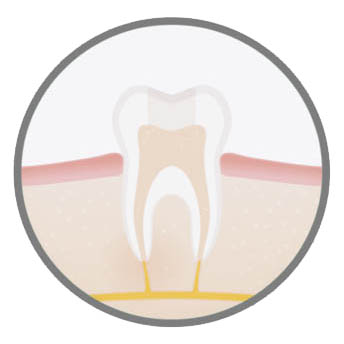 best-endodontic-procedure