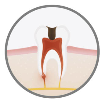 best-endodontic-treatment-in-london