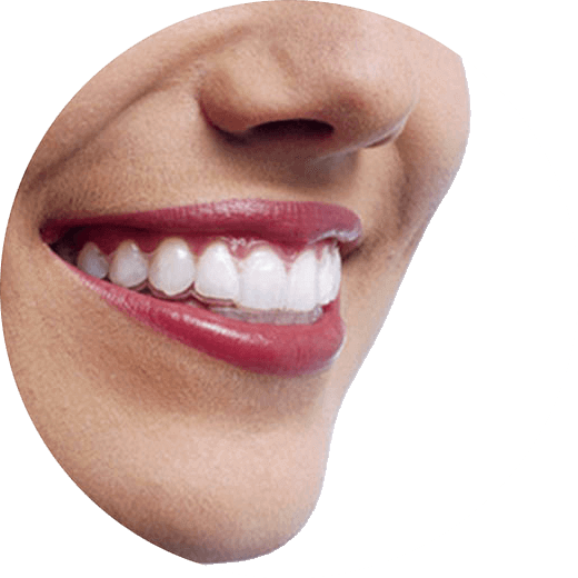celebrity-dental-orthodontics-london