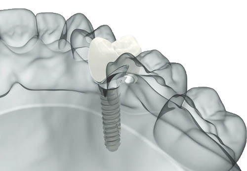 Anatomia del sorriso