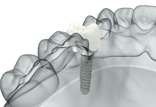 Anatomia del sorriso